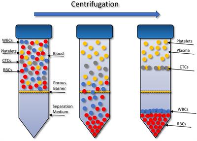 Evaluating circulating tumour cell enrichment techniques to establish an appropriate method for clinical application in glioblastomas